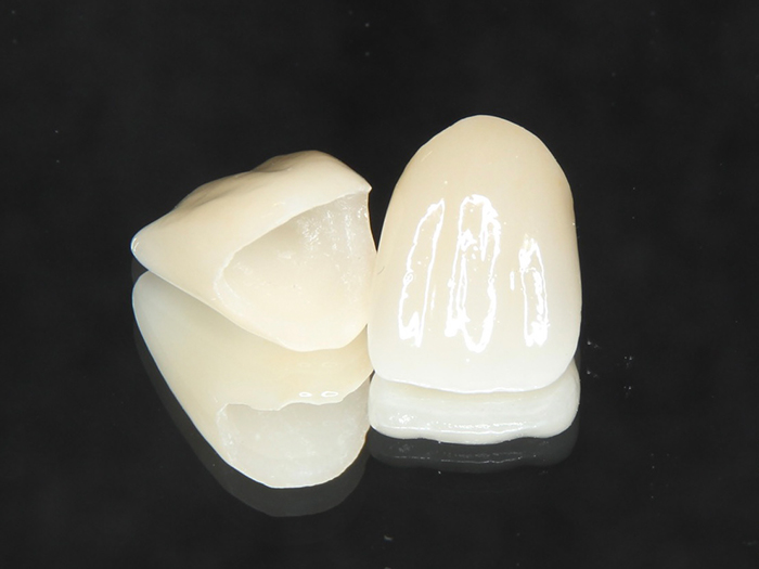 オールセラミック